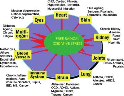 slobodni_radikali - oksidativni_stres